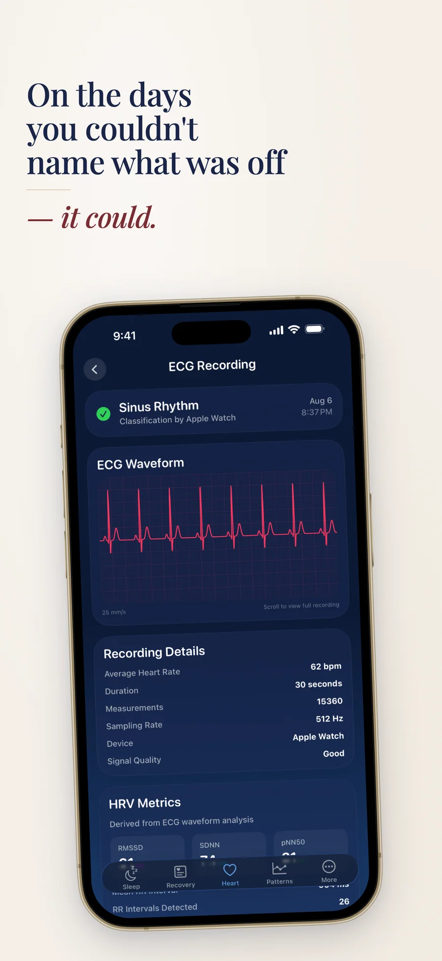 Observa ECG recording from Apple Health next to HRV values