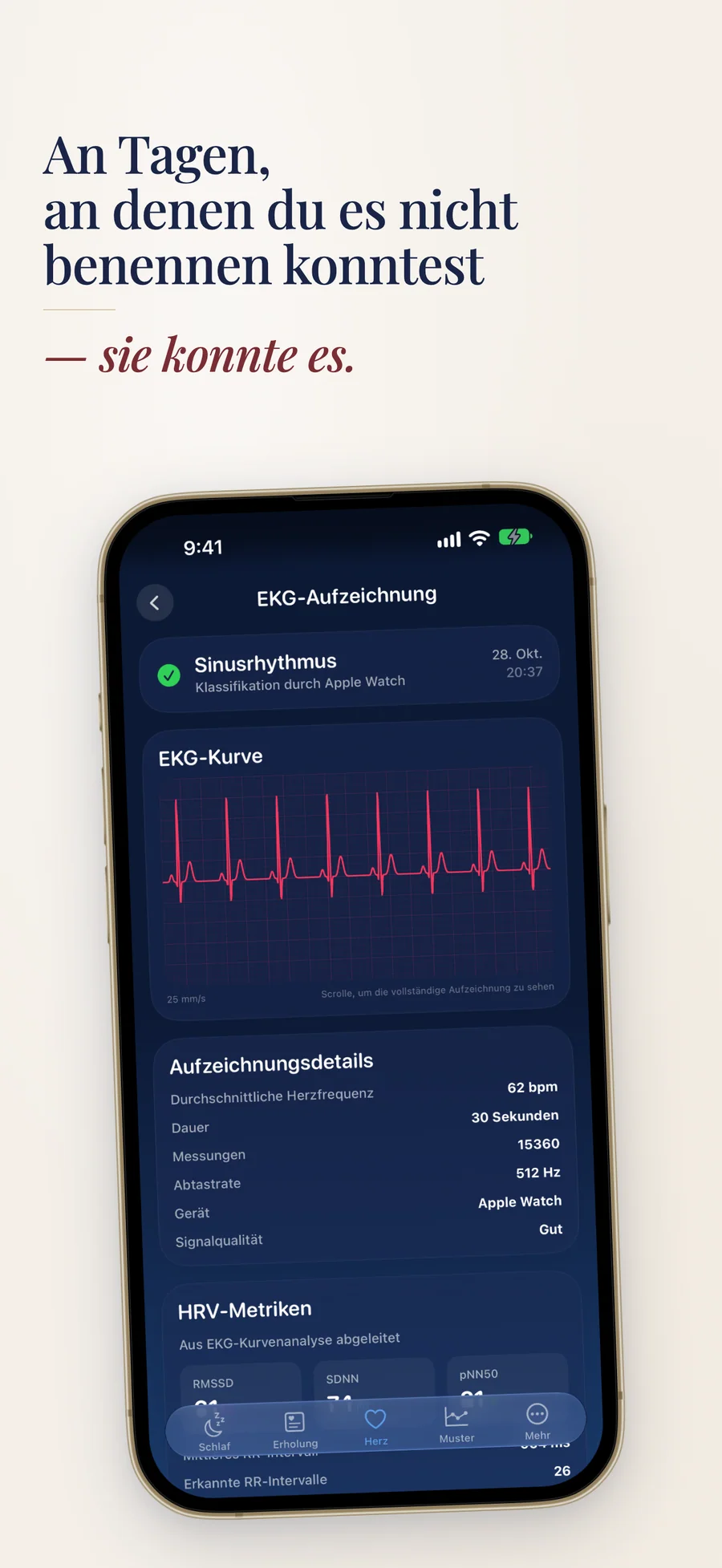 EKG-Aufzeichnung aus Apple Health in Observa neben HRV-Werten